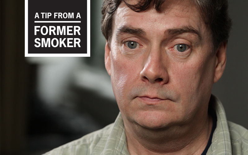 Brett&rsquo;s &ldquo;Tooth Loss Isn&rsquo;t Pretty&rdquo; Story - A Tip From a Former Smoker