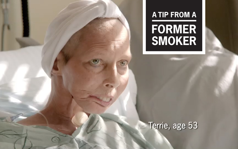 Terrie&rsquo;s &ldquo;Surgeon General&rdquo; Tips Commercial - A Tip From A Former Smoker